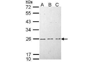 Western Blotting (WB) image for anti-HRas proto-oncogene, GTPase (HRAS) (C-Term) antibody (ABIN2857002)