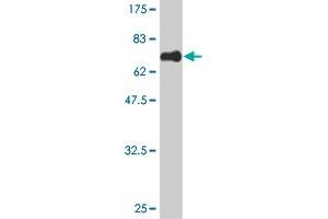 Western Blot detection against Immunogen (63. (MAGEB1 抗体  (AA 1-347))