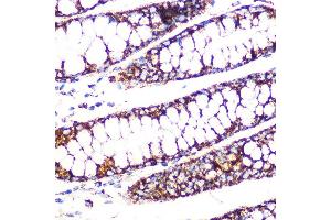Immunohistochemistry of paraffin-embedded human colon using DLDH/DLD Rabbit mAb (ABIN7266766) at dilution of 1:100 (40x lens). (DLD 抗体)