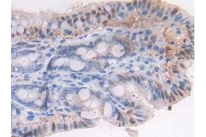 Detection of LTBP1 in Mouse Small intestine Tissue using Polyclonal Antibody to Latent Transforming Growth Factor Beta Binding Protein 1 (LTBP1)