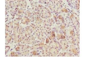 Immunohistochemistry of paraffin-embedded human pancreatic tissue using ABIN7175453 at dilution of 1:100 (BNIP1 抗体  (AA 1-200))