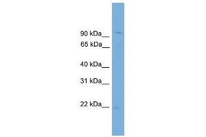 TPPP3 antibody used at 1 ug/ml to detect target protein. (TPPP3 抗体  (N-Term))