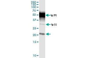 Immunoprecipitation of TMEM126B transfected lysate using rabbit polyclonal anti-TMEM126B and Protein A Magnetic Bead (TMEM126B (人) IP-WB Antibody Pair)