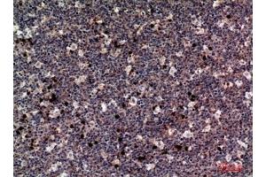 Immunohistochemical analysis of paraffin-embedded human-tonsils, antibody was diluted at 1:100. (M-CSF/CSF1 抗体  (C-Term))