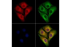 ABIN6264681 and ABIN6273070 staining Hela cells by IF/ICC. (RCN2 抗体  (C-Term))