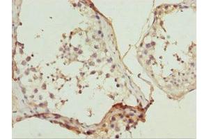 Immunohistochemistry of paraffin-embedded human testis tissue using ABIN7169215 at dilution of 1:100 (ULK4 抗体  (AA 1-290))