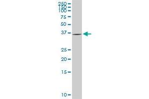 GYG1 monoclonal antibody (M08), clone 2C10. (Glycogenin 1 抗体  (AA 1-73))