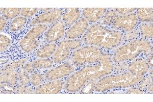 Detection of RIPK3 in Human Kidney Tissue using Polyclonal Antibody to Receptor Interacting Serine Threonine Kinase 3 (RIPK3) (RIPK3 抗体  (AA 1-217))