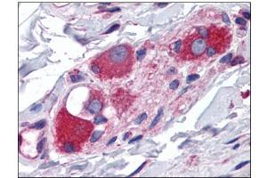 Human Small Intestine, Submucosal Plexus: Formalin-Fixed, Paraffin-Embedded (FFPE) (ARL6IP5 抗体  (C-Term))