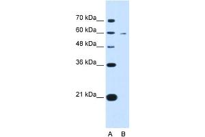 WB Suggested Anti-KYNU Antibody Titration:  0. (KYNU 抗体  (C-Term))