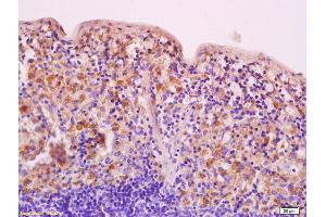 Formalin-fixed and paraffin embedded human brain labeled with Anti-HDAC5 Polyclonal Antibody, Unconjugated (ABIN681043) at 1:200 followed by conjugation to the secondary antibody and DAB staining (HDAC5 抗体)