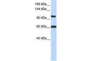 WB Suggested Anti-THRAP3 Antibody Titration:  0. (THRAP3 抗体  (Middle Region))