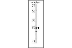 Image no. 1 for anti-Protein Tyrosine Phosphatase Type IVA, Member 1 (PTP4A1) antibody (ABIN360770) (PTP4A1 抗体)