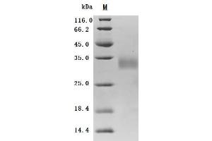 Sclerostin (SOST) (AA 24-213), (full length) (Active) protein (His tag)