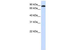 ADAM19 antibody used at 1 ug/ml to detect target protein.