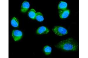 IF analysis of FXR1 using anti-FXR1 antibody (ABIN7600093). (FXR1 抗体  (AA 149-614))