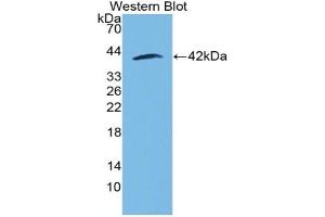 Western blot analysis of the recombinant protein. (MGP 抗体  (AA 23-103))
