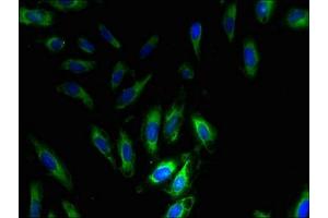Immunofluorescent analysis of Hela cells using ABIN7169869 at dilution of 1:100 and Alexa Fluor 488-congugated AffiniPure Goat Anti-Rabbit IgG(H+L) (SNRPG 抗体  (AA 1-76))