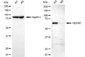 Western blotting analysis using HEXIM1 antibody (ABIN7798905).