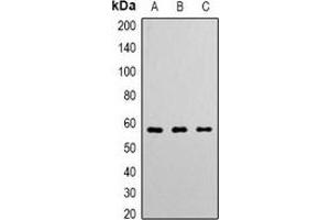 Western blot analysis of Angiopoietin-1 expression in K562 (A), Hela (B), Jurkat (C) whole cell lysates. (Angiopoietin 1 抗体  (N-Term))