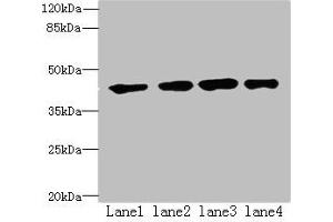 Western blot All lanes: QTRT1 antibody at 6 μg/mL Lane 1: MCF-7 whole cell lysate Lane 2: PC-3 whole cell lysate Lane 3: Jurkat whole cell lysate Lane 4: A431 whole cell lysate Secondary Goat polyclonal to rabbit IgG at 1/10000 dilution Predicted band size: 45, 25 kDa Observed band size: 45 kDa (QTRT1 抗体  (Catalytic Subunit 1))