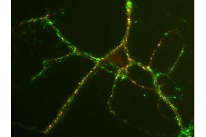 Immunostaining of rat hippocampus neurons with anti-SV2 C (red; dilution: 1 : 500) and anti-synaptophysin (cat. (SV2C 抗体  (AA 2-16))