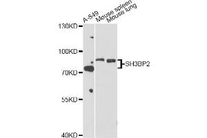 Western blot analysis of extracts of various cell lines, using SH3BP2 antibody (ABIN5998800) at 1/1000 dilution. (SH3BP2 抗体)