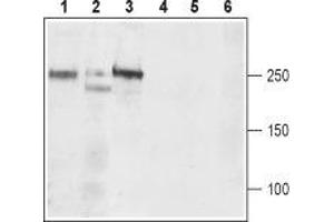 Western blot analysis of rat brain (lanes 1 and 4), mouse brain (lanes 2 and 5), and rat C6  brain Glioma (lanes 3 and 6) lysates: - 1-3. (CACNA1D 抗体  (2nd Extracellular Loop, Repeat region))