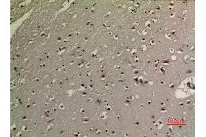 Immunohistochemistry (IHC) analysis of paraffin-embedded Human Brain, antibody was diluted at 1:100. (Tumor Protein p73 抗体  (acLys321))