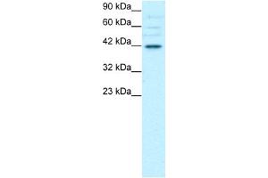Western Blotting (WB) image for anti-POU Domain, Class 3, Transcription Factor 4 (POU3F4) (C-Term) antibody (ABIN2792648)