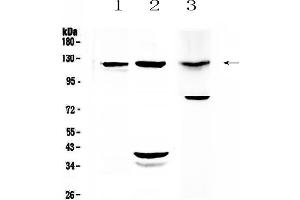 Western blot analysis of MUC1 using anti-MUC1 antibody . (MUC1 抗体  (AA 1062-1139))