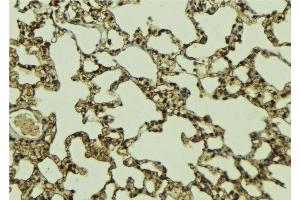 ABIN6268833 at 1/100 staining Mouse lung tissue by IHC-P. (Menin 抗体  (Internal Region))