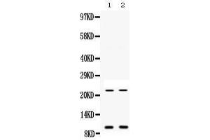 Western blot analysis of Prokineticin 1 expression in mouse liver extract (lane 1) and mouse spleen extract (lane 2). (Prokineticin 1 抗体  (AA 20-105))