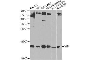 Western blot analysis of extracts of various cell lines, using VIP Antibody. (Vip 抗体  (AA 31-170))