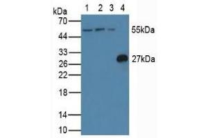 Western blot analysis of (1) Human Jurkat Cells, (2) Human HeLa cells, (3) Human K562 Cells and (4) Rat Spleen Tissue. (FLIP 抗体  (AA 43-281))