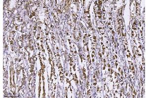 IHC analysis of MUC2 using anti-MUC2 antibody (ABIN7600606).