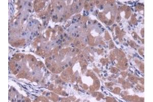 Detection of COVA1 in Human Stomach Tissue using Polyclonal Antibody to Cytosolic Ovarian Carcinoma Antigen 1 (COVA1) (ENOX2 抗体  (AA 1-207))