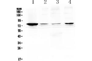 Western blot analysis of RANK using anti-RANK antibody . (TNFRSF11A 抗体  (AA 34-211))