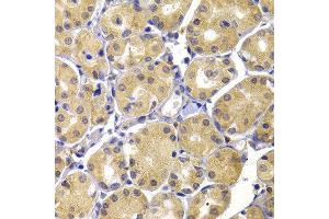 Immunohistochemistry of paraffin-embedded human stomach using UBIAD1 antibody at dilution of 1:100 (40x lens). (UBIAD1 抗体)