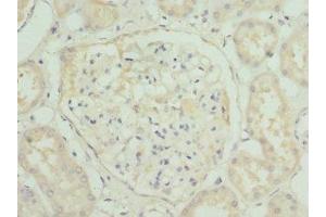 Immunohistochemistry of paraffin-embedded human kidney tissue using ABIN7155891 at dilution of 1:100 (HGD 抗体  (AA 226-445))