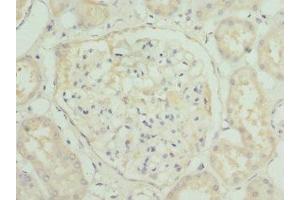 Immunohistochemistry of paraffin-embedded human kidney tissue using ABIN7155891 at dilution of 1:100 (HGD 抗体  (AA 226-445))