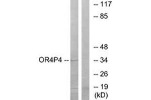 Western blot analysis of extracts from HeLa cells, using OR4P4 Antibody. (OR4P4 抗体  (AA 260-309))