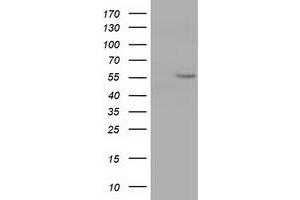 Western Blotting (WB) image for anti-Cytochrome P450, Family 1, Subfamily A, Polypeptide 2 (CYP1A2) antibody (ABIN1497715) (CYP1A2 抗体)