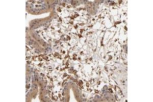 Immunohistochemical staining of human testis with VSIG4 polyclonal antibody  shows strong nuclear positivity in cells in seminiferus ducts. (VSIG4 抗体)
