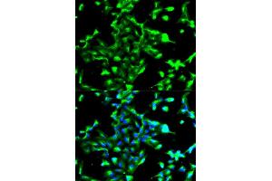Immunofluorescence analysis of A549 cell using ANXA2 antibody. (Annexin A2 抗体)