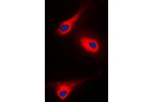 Immunofluorescent analysis of PLC gamma 1 (pY1253) staining in A431 cells. (Phospholipase C gamma 1 抗体  (C-Term, pTyr1253))