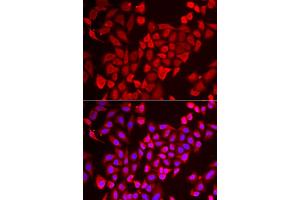 Immunofluorescence analysis of U2OS cells using TNP2 antibody (ABIN5974101). (TNP2 抗体)