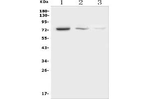 Western blot analysis of NDC80 using anti-NDC80 antibody (ABIN7602585).