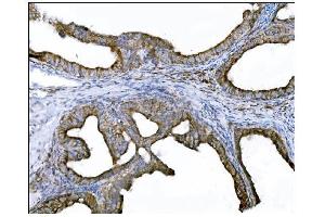 IHC analysis of DLGAP1 using anti-DLGAP1 antibody (ABIN7600257). (DLGAP1 抗体  (AA 17-319))