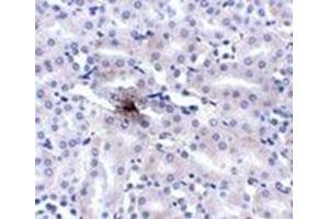 Immunohistochemistry (Paraffin-embedded Sections) (IHC (p)) image for anti-Solute Carrier Family 39 (Metal Ion Transporter), Member 11 (SLC39A11) (Center) antibody (ABIN501159)